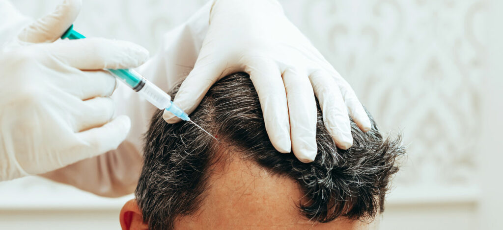 Cosmetologist performs anti-aging procedures injections hyaluronic acid into scalp, hair growth prevention hair loss man