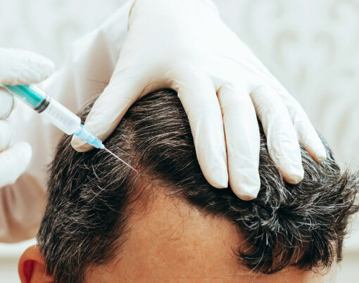 Cosmetologist performs anti-aging procedures injections hyaluronic acid into scalp, hair growth prevention hair loss man